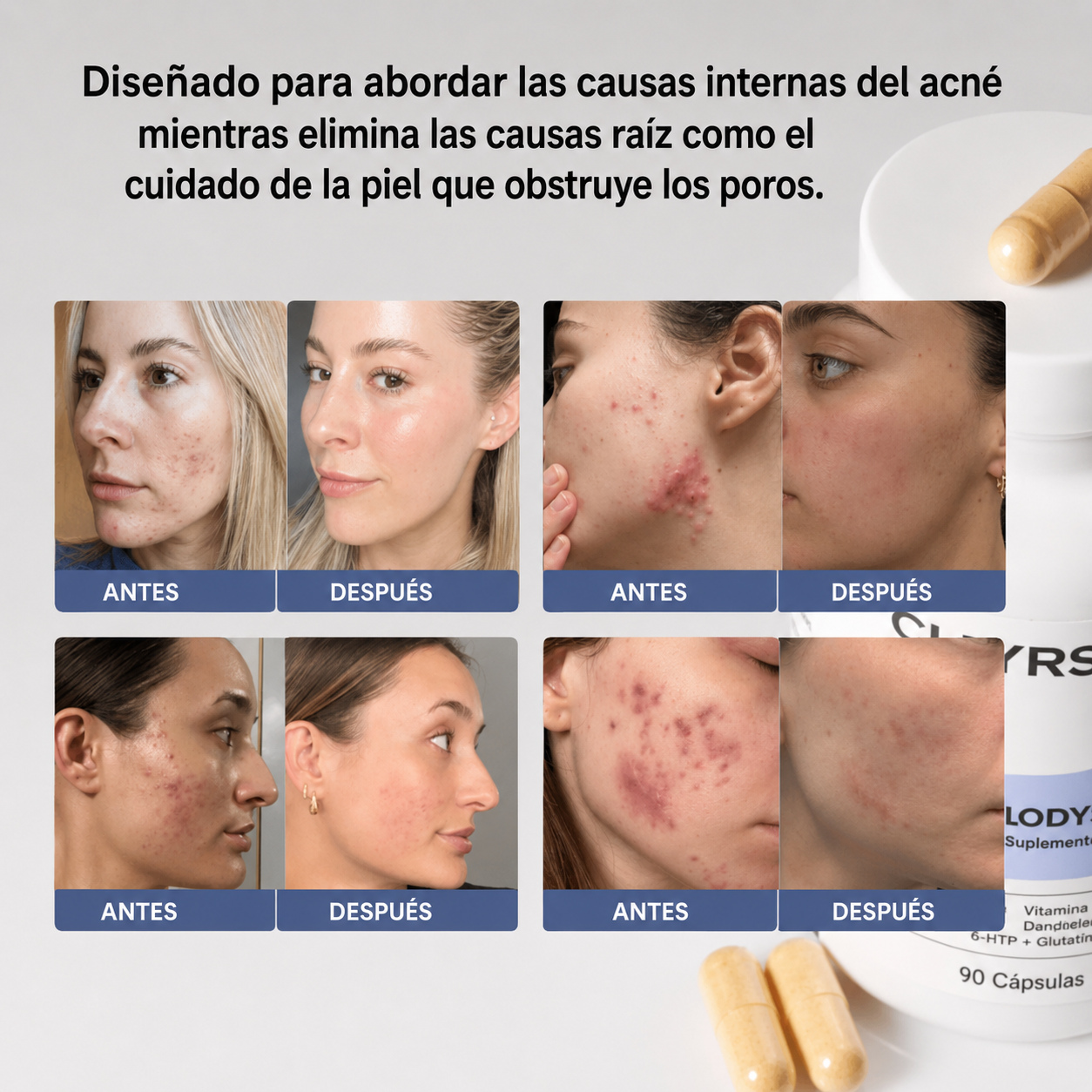 Clearstem Tratamiento Acne